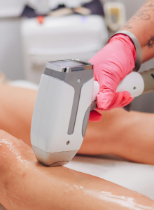 Laser Hair Removal (Diolaze XL)